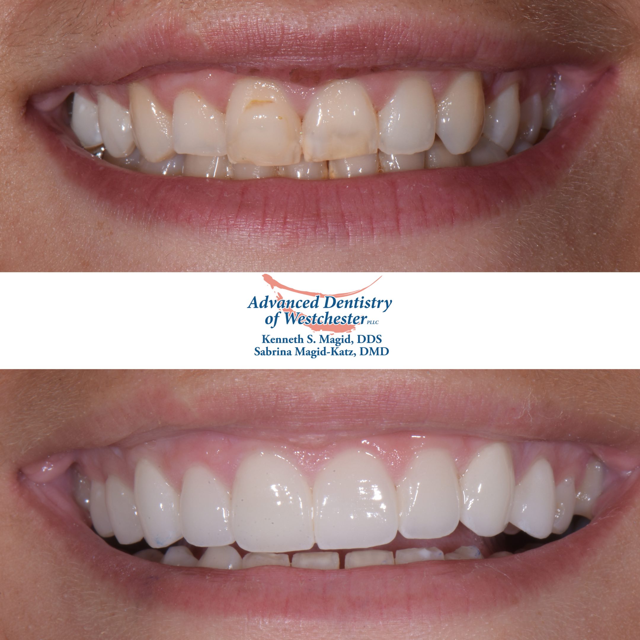 Cosmetic Dentist | Westchester Dentist | White Plains