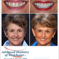 A woman 's smile is shown in two different photos.