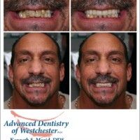 A man with a mustache and beard smiling.