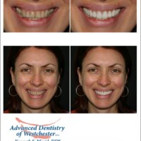 A woman 's face with different expressions on her.